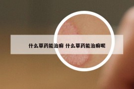 什么草药能治癣 什么草药能治癣呢