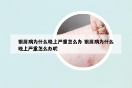 银屑病为什么晚上严重怎么办 银屑病为什么晚上严重怎么办呢