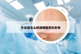 牛皮癣怎么样调理肠胃的食物