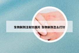 生物制剂注射针图片 生物制剂怎么打针