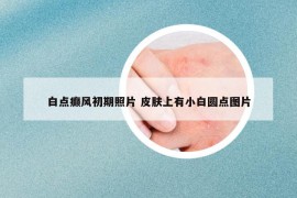 白点癫风初期照片 皮肤上有小白圆点图片