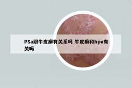 PSa跟牛皮癣有关系吗 牛皮癣和hpv有关吗