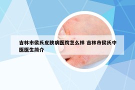 吉林市侯氏皮肤病医院怎么样 吉林市侯氏中医医生简介