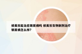 修美乐能治愈银屑病吗 修美乐生物制剂治疗银屑病怎么样?