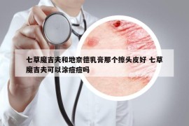 七草魔吉夫和地奈德乳膏那个擦头皮好 七草魔吉夫可以涂痘痘吗