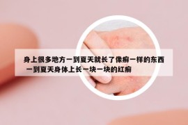身上很多地方一到夏天就长了像癣一样的东西 一到夏天身体上长一块一块的红癣