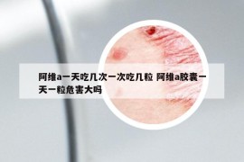 阿维a一天吃几次一次吃几粒 阿维a胶囊一天一粒危害大吗