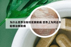 为什么世界没有功克银屑病 世界上为何还不能根治银屑病