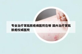 专业治疗掌跖脓疱病医院在哪 国内治疗掌跖脓疱权威医院