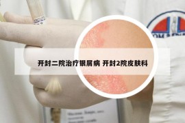 开封二院治疗银屑病 开封2院皮肤科