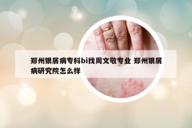 郑州银屑病专科bi找周文敬专业 郑州银屑病研究院怎么样