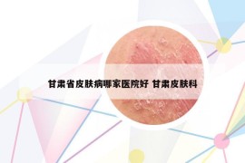 甘肃省皮肤病哪家医院好 甘肃皮肤科