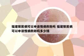 福建银屑病可以申请慢病救助吗 福建银屑病可以申请慢病救助吗多少钱