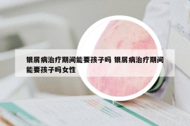 银屑病治疗期间能要孩子吗 银屑病治疗期间能要孩子吗女性