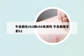 牛皮癣吃vb2跟vb6有用吗 牛皮癣维生素b2