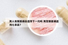 男人有银屑病会遗传下一代吗 男性银屑病遗传几率高?