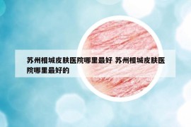 苏州相城皮肤医院哪里最好 苏州相城皮肤医院哪里最好的