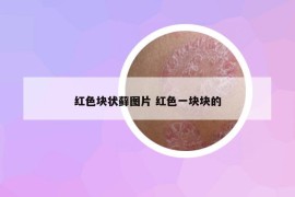 红色块状藓图片 红色一块块的