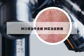 树汁液治牛皮癣 树浆治皮肤病