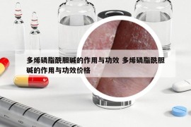 多烯磷脂酰胆碱的作用与功效 多烯磷脂酰胆碱的作用与功效价格