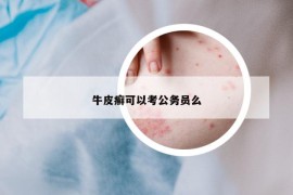 牛皮癣可以考公务员么