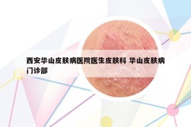 西安华山皮肤病医院医生皮肤科 华山皮肤病门诊部