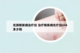 光源银屑病治疗仪 治疗银屑病光疗仪sh4多少钱