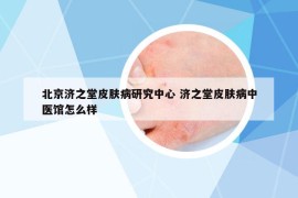 北京济之堂皮肤病研究中心 济之堂皮肤病中医馆怎么样