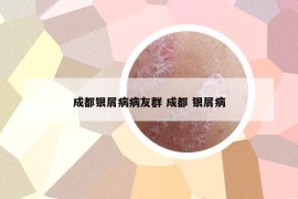 成都银屑病病友群 成都 银屑病