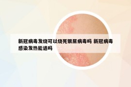 新冠病毒发烧可以烧死银屑病毒吗 新冠病毒感染发热能退吗