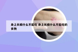 身上长癣什么不能吃 身上长癣什么不能吃的食物
