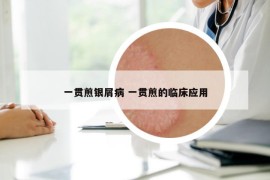 一贯煎银屑病 一贯煎的临床应用