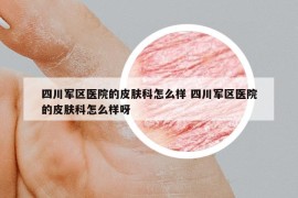 四川军区医院的皮肤科怎么样 四川军区医院的皮肤科怎么样呀