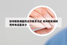 郑州银屑病医院合作联系方式 郑州银屑病研究所电话是多少