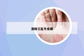清除三乱牛皮癣