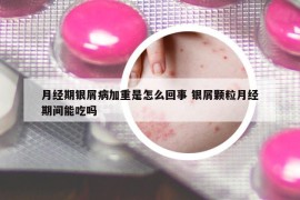 月经期银屑病加重是怎么回事 银屑颗粒月经期间能吃吗