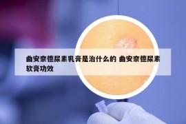 曲安奈德尿素乳膏是治什么的 曲安奈德尿素软膏功效