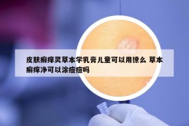 皮肤癣痒灵草本学乳膏儿童可以用撩么 草本癣痒净可以涂痘痘吗