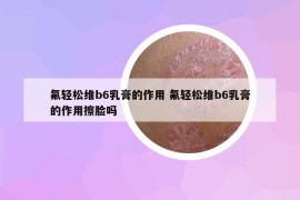 氟轻松维b6乳膏的作用 氟轻松维b6乳膏的作用擦脸吗