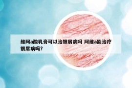 维阿a酸乳膏可以治银屑病吗 阿维a能治疗银屑病吗?