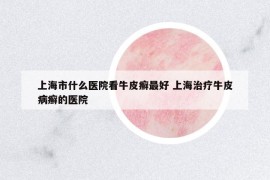 上海市什么医院看牛皮癣最好 上海治疗牛皮病癣的医院