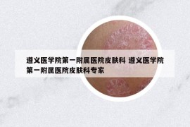 遵义医学院第一附属医院皮肤科 遵义医学院第一附属医院皮肤科专家