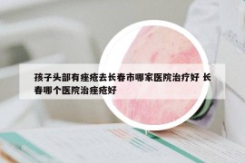 孩子头部有痤疮去长春市哪家医院治疗好 长春哪个医院治痤疮好