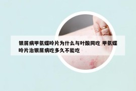 银屑病甲氨蝶呤片为什么与叶酸同吃 甲氨蝶呤片治银屑病吃多久不能吃