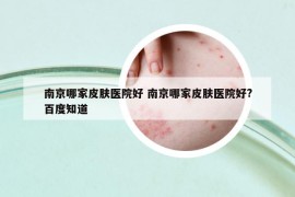 南京哪家皮肤医院好 南京哪家皮肤医院好?百度知道