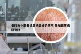 贵阳市中医看银屑病最好的医院 贵阳银屑病研究院