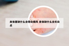 身体里缺什么会得白癜风 身体缺什么会长白点