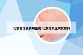 北京合谐皮肤病医院 北京谐和医院皮肤科