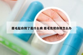 眉毛起白斑了是什么病 眉毛出现白斑怎么办