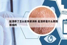 起湿疹了怎么能快速消除 起湿疹是什么原因造成的